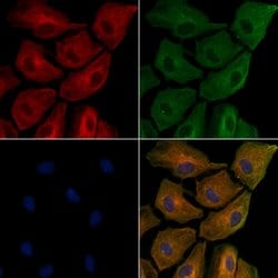 Invitrogen ApoC3 Polyclonal Antibody 100 &mu;L; Unconjugated:Antibodies,