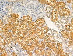 Invitrogen ARF1/ARF3/ARF5/ARF6 Polyclonal Antibody 100 &mu;L; Unconjugated:Antibodies,