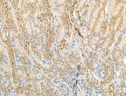 Invitrogen ARF1/ARF3/ARF5/ARF6 Polyclonal Antibody 100 &mu;L; Unconjugated:Antibodies,