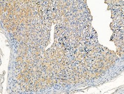 Invitrogen ARF1/ARF3/ARF5/ARF6 Polyclonal Antibody 100 &mu;L; Unconjugated:Antibodies,