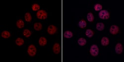 Invitrogen ARIH2 Polyclonal Antibody 100 &mu;L; Unconjugated:Antibodies,