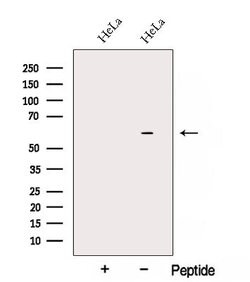 Invitrogen ARIH2 Polyclonal Antibody 100 &mu;L; Unconjugated:Antibodies,