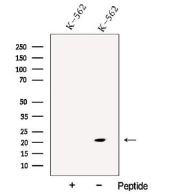 Invitrogen p21 ARC Polyclonal Antibody 100 &mu;L; Unconjugated:Antibodies,
