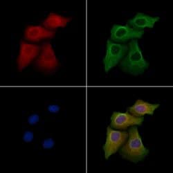 Invitrogen CD297 Polyclonal Antibody 100 &mu;L; Unconjugated:Antibodies,
