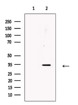 Invitrogen CD297 Polyclonal Antibody 100 &mu;L; Unconjugated:Antibodies,