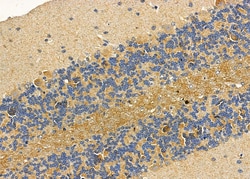 ASAP1 Polyclonal Antibody:Antibodies, Polyclonal