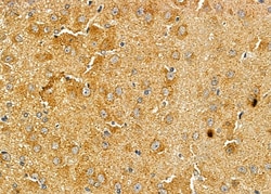 ASAP1 Polyclonal Antibody:Antibodies, Polyclonal