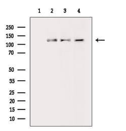 ASAP1 Polyclonal Antibody:Antibodies, Polyclonal