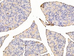 Invitrogen Asporin Polyclonal Antibody 100 &mu;L; Unconjugated:Antibodies,