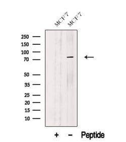 Invitrogen C12orf11 Polyclonal Antibody 100 μL; Unconjugated:Antibodies,