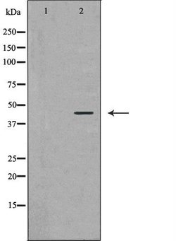 Invitrogen Ataxin 3 Polyclonal Antibody 100 &mu;L; Unconjugated:Antibodies,