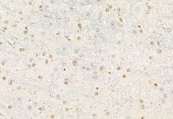 Invitrogen ATF6 Polyclonal Antibody 100 &mu;L; Unconjugated:Antibodies,