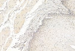 Invitrogen ATF6 Polyclonal Antibody 100 &mu;L; Unconjugated:Antibodies,