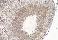 Invitrogen ATF6 Polyclonal Antibody 100 &mu;L; Unconjugated:Antibodies,