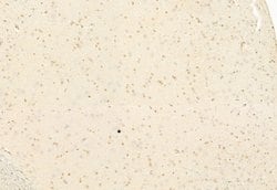 Invitrogen ATF6 Polyclonal Antibody 100 &mu;L; Unconjugated:Antibodies,