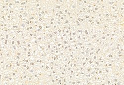 Invitrogen ATF6 Polyclonal Antibody 100 &mu;L; Unconjugated:Antibodies,
