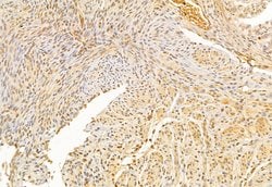 Invitrogen ATF6 Polyclonal Antibody 100 &mu;L; Unconjugated:Antibodies,