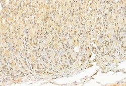 Invitrogen ATF6 Polyclonal Antibody 100 &mu;L; Unconjugated:Antibodies,