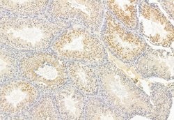 Invitrogen ATF6 Polyclonal Antibody 100 &mu;L; Unconjugated:Antibodies,