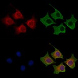 Invitrogen BAGE2 Polyclonal Antibody 100 &mu;L | Buy Online | Invitrogen&trade; | Fisher Scientific