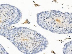 Invitrogen BAGE2 Polyclonal Antibody 100 &mu;L | Buy Online | Invitrogen&trade; | Fisher Scientific