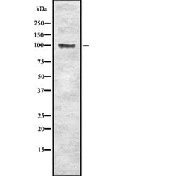 Invitrogen SLC4A1 Polyclonal Antibody 100 &mu;L | Buy Online | Invitrogen&trade; | Fisher Scientific