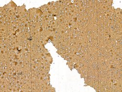 Invitrogen Bassoon Polyclonal Antibody 100 &mu;L; Unconjugated:Antibodies,