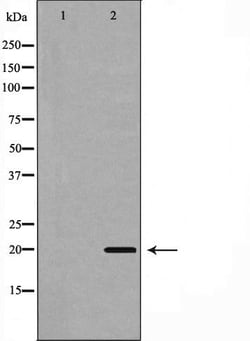 Invitrogen PUMA alpha Polyclonal Antibody 100 &mu;L; Unconjugated:Antibodies,