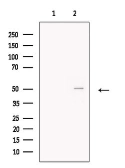 Invitrogen BCKDHA Polyclonal Antibody 100 &mu;L | Buy Online | Invitrogen&trade; | Fisher Scientific