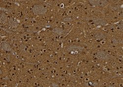 Invitrogen BCL11A Polyclonal Antibody 100 &mu;L; Unconjugated:Antibodies,