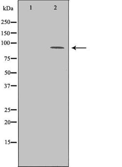 Invitrogen BCL11A Polyclonal Antibody 100 &mu;L; Unconjugated:Antibodies,
