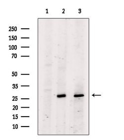 Invitrogen BCL-2 Polyclonal Antibody 100 &mu;L; Unconjugated:Antibodies,