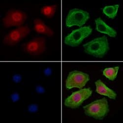 Invitrogen BCL-2 Polyclonal Antibody 100 &mu;L; Unconjugated:Antibodies,