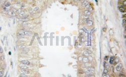 Invitrogen BCL-2 Polyclonal Antibody 100 &mu;L; Unconjugated:Antibodies,