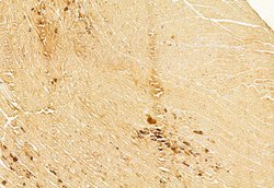 Invitrogen BCL-2 Polyclonal Antibody 100 &mu;L; Unconjugated:Antibodies,