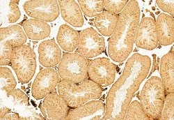 Invitrogen BCL-2 Polyclonal Antibody 100 &mu;L; Unconjugated:Antibodies,