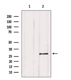 Invitrogen BCL-2 Polyclonal Antibody 100 &mu;L; Unconjugated:Antibodies,