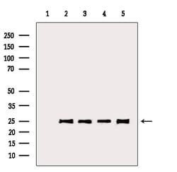 Invitrogen BCL-2 Polyclonal Antibody 100 &mu;L; Unconjugated:Antibodies,