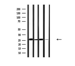 Invitrogen BCL-2 Polyclonal Antibody 100 &mu;L; Unconjugated:Antibodies,