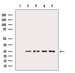 Invitrogen BCL-2 Polyclonal Antibody 100 &mu;L; Unconjugated:Antibodies,