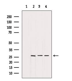 Invitrogen BCL-2 Polyclonal Antibody 100 &mu;L; Unconjugated:Antibodies,