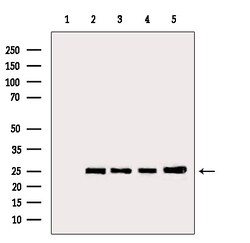 Invitrogen BCL-2 Polyclonal Antibody 100 &mu;L; Unconjugated:Antibodies,