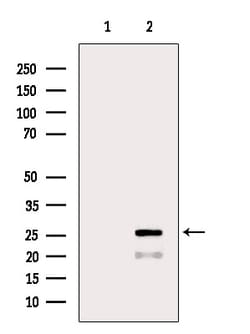 Invitrogen BCL-2 Polyclonal Antibody 100 &mu;L; Unconjugated:Antibodies,