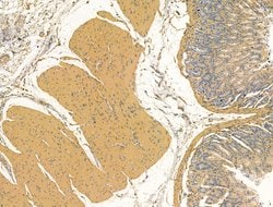 Bestrophin 2 Polyclonal Antibody:Antibodies, Polyclonal