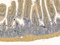 Bestrophin 2 Polyclonal Antibody:Antibodies, Polyclonal