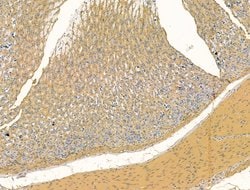 Bestrophin 2 Polyclonal Antibody:Antibodies, Polyclonal