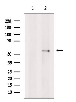 Bestrophin 2 Polyclonal Antibody:Antibodies, Polyclonal