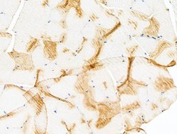 Invitrogen Tubulin beta-2C Polyclonal Antibody 100 &mu;L | Buy Online | Invitrogen&trade; | Fisher Scientific