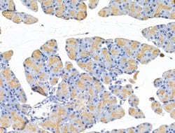 Invitrogen Tubulin beta-2C Polyclonal Antibody 100 &mu;L | Buy Online | Invitrogen&trade; | Fisher Scientific