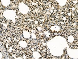 Invitrogen BLM Polyclonal Antibody 100 μL; Unconjugated:Antibodies,